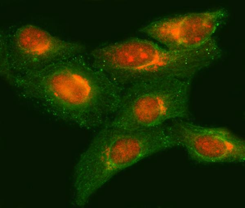 Anti-METTL11A/NTMT1 Antibody