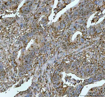 Anti-METTL11A/NTMT1 Antibody