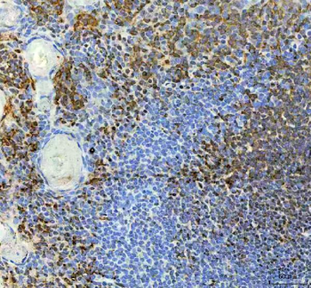 Anti-METTL11A/NTMT1 Antibody