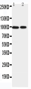 Band 4.1-like protein 1 EPB41L1 Antibody