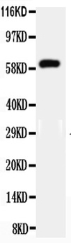 HNF1 beta/HNF1B Antibody