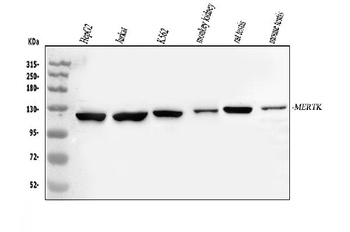 Anti-Tyrosine-protein kinase Mer MERTK Antibody