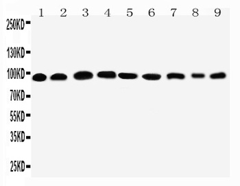 Plakophilin 2/PKP2 Rabbit Polyclonal Antibody