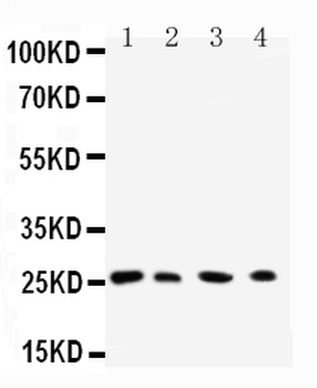 Ras-related protein Rab-3C Rab3C Antibody