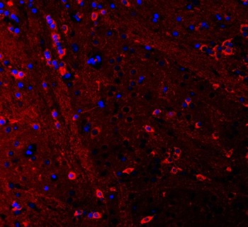 PSD95/DLG4 Antibody