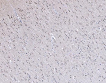 Anti-PSD95/DLG4 Antibody
