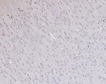 PSD95/DLG4 Antibody