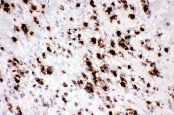 Mucin 5AC/MUC5AC Antibody