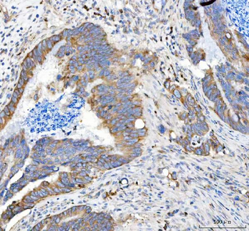 Anti-APLP2 Antibody