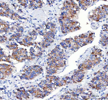 Anti-APLP2 Antibody