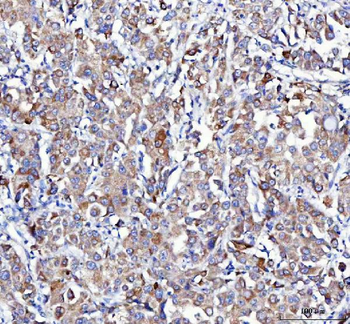 Anti-APLP2 Antibody
