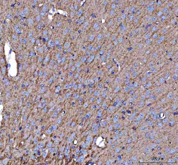 Anti-APLP2 Antibody