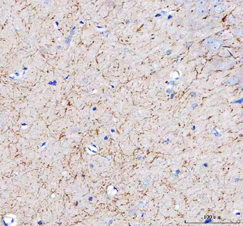Anti-APLP2 Antibody