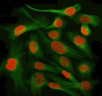 Anti-AHRR Antibody