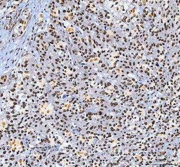 Anti-AHRR Antibody