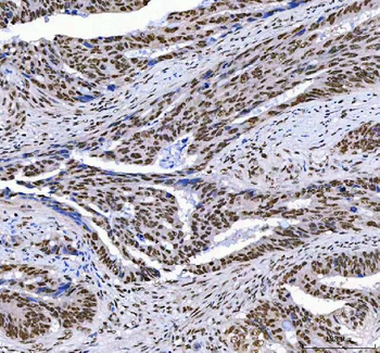 Anti-AHRR Antibody