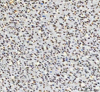 Anti-AHRR Antibody