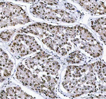 Anti-AHRR Antibody