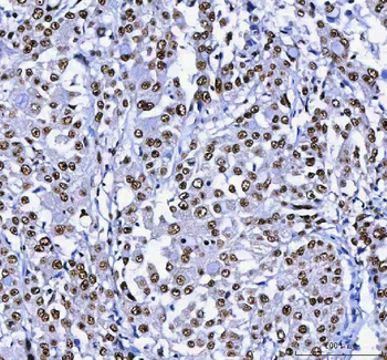 Anti-AHRR Antibody