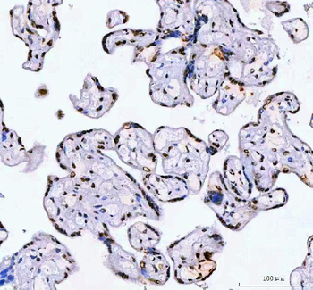 Anti-AHRR Antibody