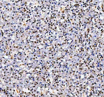 Anti-AHRR Antibody