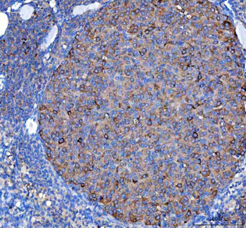 Anti-MVD Antibody