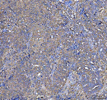 Anti-LAP3 Antibody