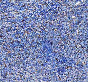 Anti-LAP3 Antibody