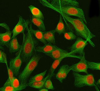 Anti-PSIP1 Antibody