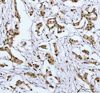 Anti-PSIP1 Antibody