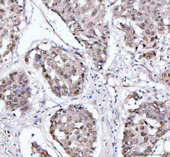 Anti-PSIP1 Antibody
