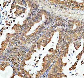 Anti-PSIP1 Antibody