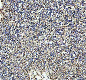 Anti-PSIP1 Antibody