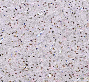 Anti-PSIP1 Antibody