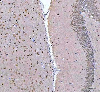Anti-PSIP1 Antibody