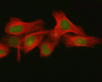 Anti-FBXO32 Antibody