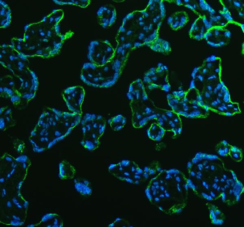 Anti-AGL Antibody