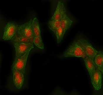 Anti-AGL Antibody