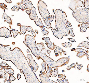 Anti-AGL Antibody