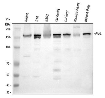 Anti-AGL Antibody