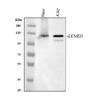 Anti-LEMD3 Antibody