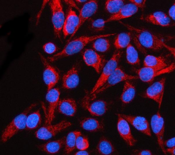 Anti-SLC38A9 Antibody