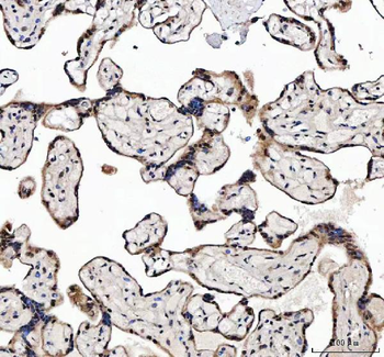 Anti-MAGEL2 Antibody