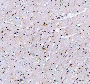 Anti-LEO1 Antibody