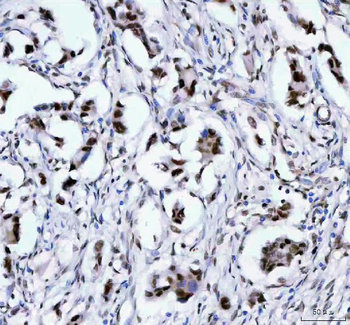 Anti-LEO1 Antibody
