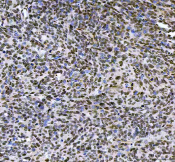 Anti-LEO1 Antibody