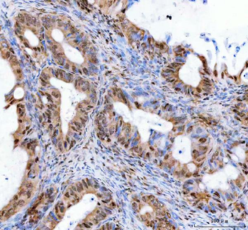 Anti-LEO1 Antibody
