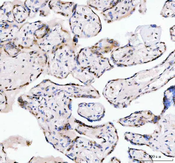 Anti-LEO1 Antibody