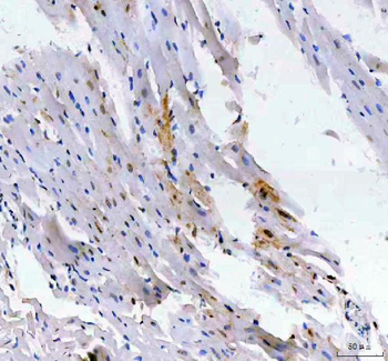Anti-LEO1 Antibody