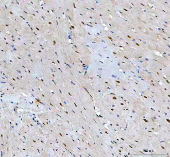 Anti-LEO1 Antibody